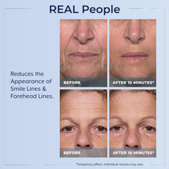 Plexaderm Rapid Reduction Eye Serum visible reduction of under-eye puffiness after use.