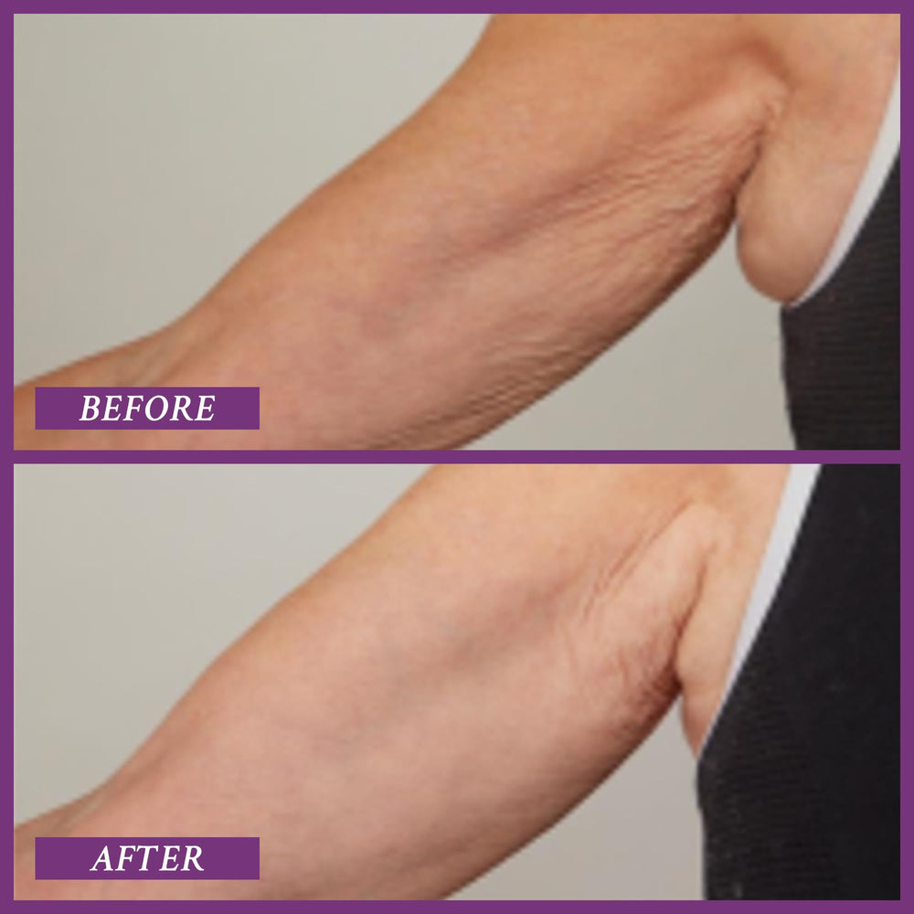 Model applying PRAI Upper Arm Creme to the upper arm.