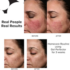 PRIORI Gel Perfector features antioxidant-rich formula with vitamins A, C, E.