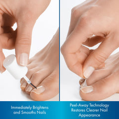 ProClearz Brite Now Nail Treatment may reduce discoloration for a more even tone.