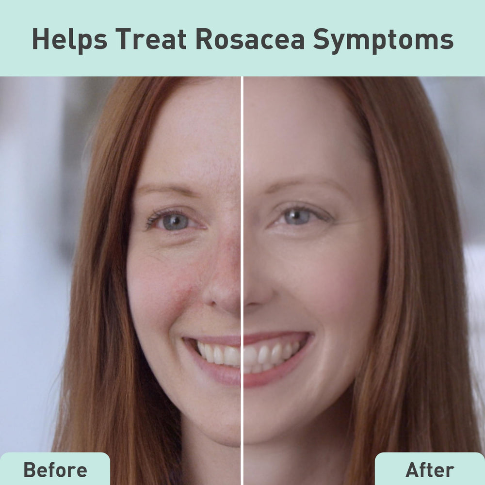 PROcure Rosacare CC Hydrogel cucumber extract provides refreshing cooling