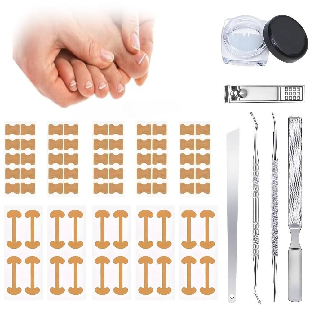 Professional Pedicure Tools ingrown-toenail kit breathable strips for comfortable wear.