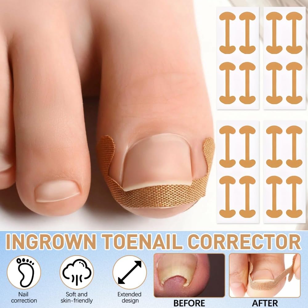 Professional Pedicure Tools precision file smooths edges for safe maintenance.