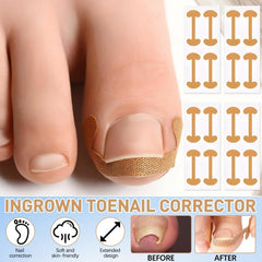 Professional Pedicure Tools precision file smooths edges for safe maintenance.