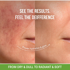PROJECT 701 liposomal hyaluronic acid application closeup showing deep hydration.