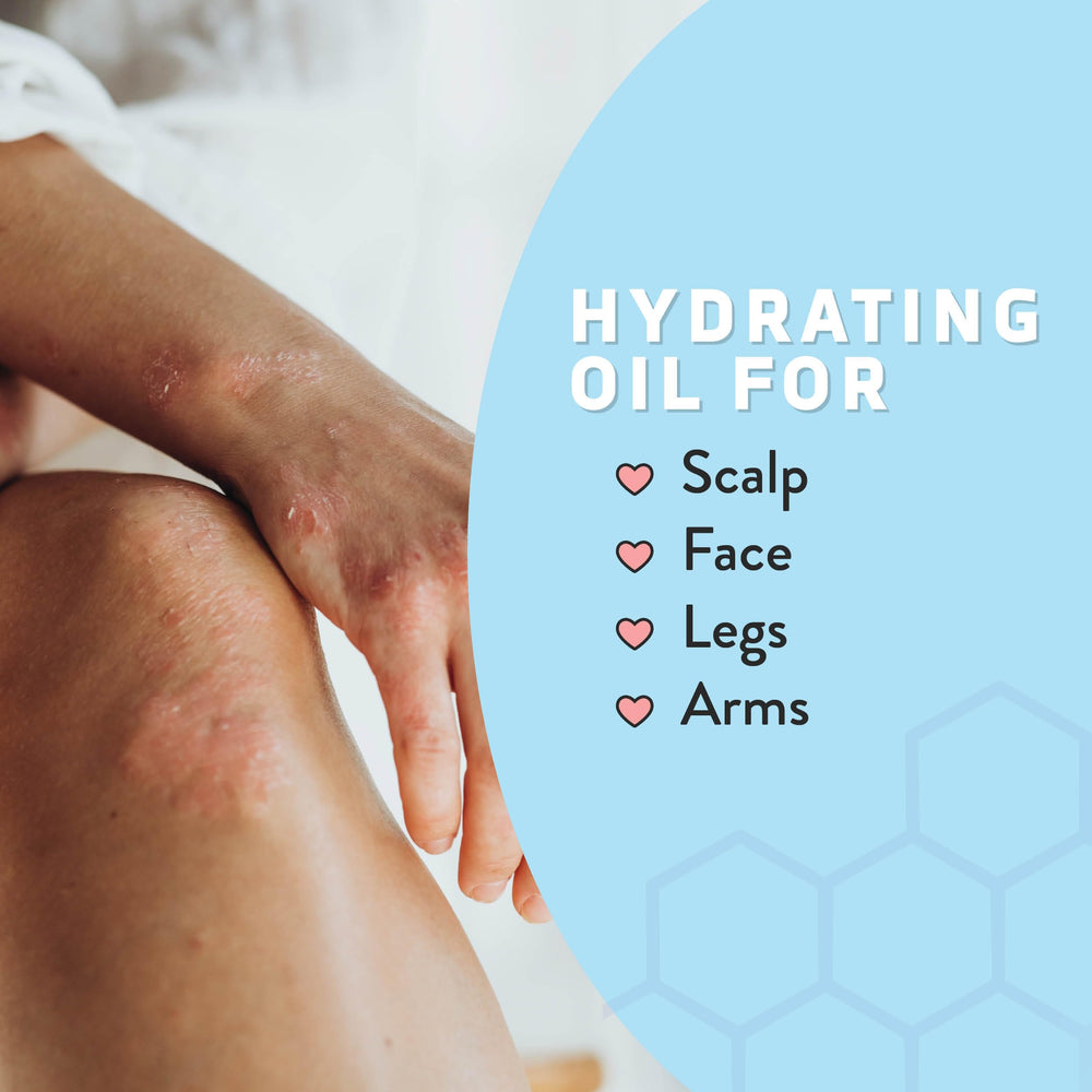 Psoriasis Honey non-greasy absorption makes it suitable for all ages