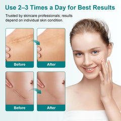 Pumkot Scar Cream lightweight formula absorbs quickly.