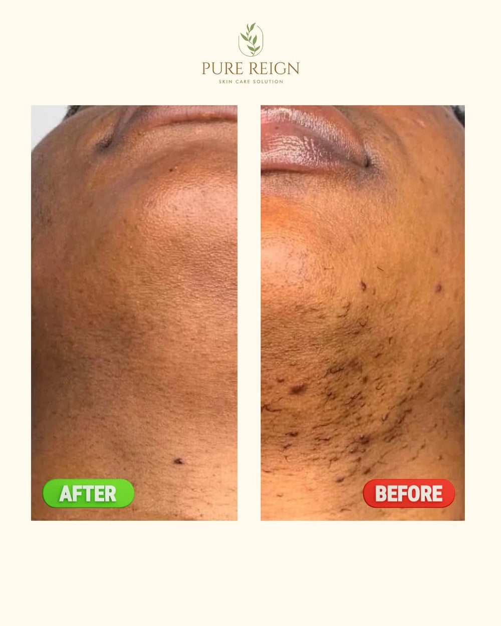 Pure Reign skin care solution bathroom display supports daily routine visualization.