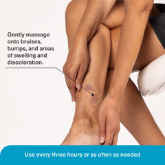 Pure Relief Arnica Cream applied to skin after minor injury for comfort.