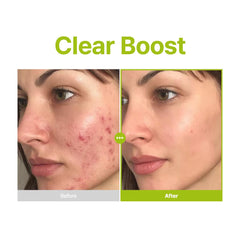 PURITO Azelaic Acid 10% packaging box presenting premium skincare packaging.