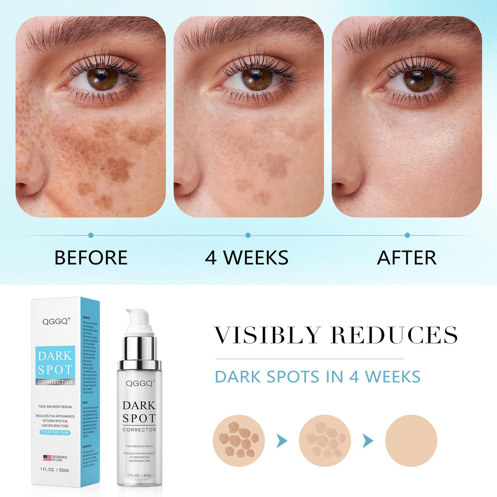 QGGQ Dark Spot Serum targets sun spots on the skin