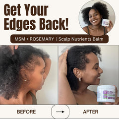 Qhemet Biologics rosemary essential oil bottle highlighting scalp support.
