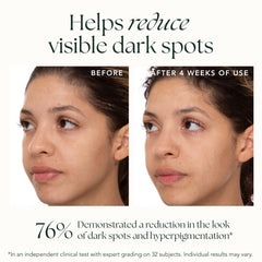 Radiant skin glow as a possible brightening outcome after use
