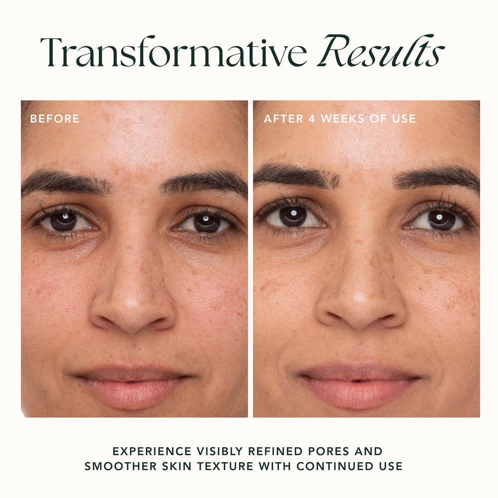 RANAVAT Botanics Refining Lotus Gel Cream drops – plump, hydrated skin with hyaluronic support.