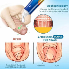 RCSCBC gel dispensing action demonstrating easy application and control
