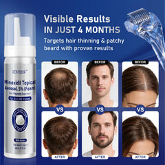 RDVHDLW minoxidil foam dries quickly with a non-greasy feel.