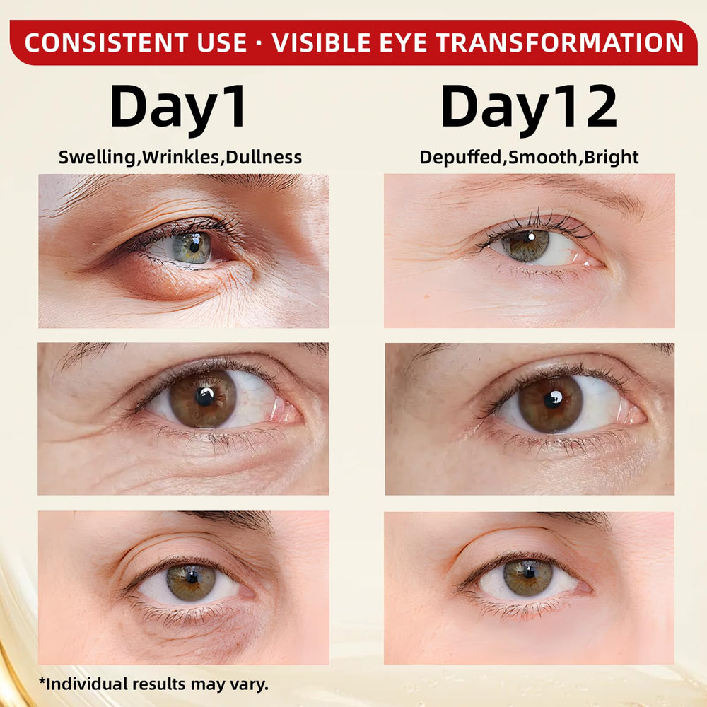 Redcool caffeine eye serum dark circles and puffiness reduction for a more awake look