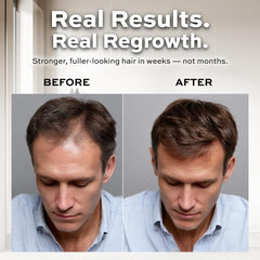 Reforian healthy shiny hair close-up showcases nourished, glossy strands after wash.