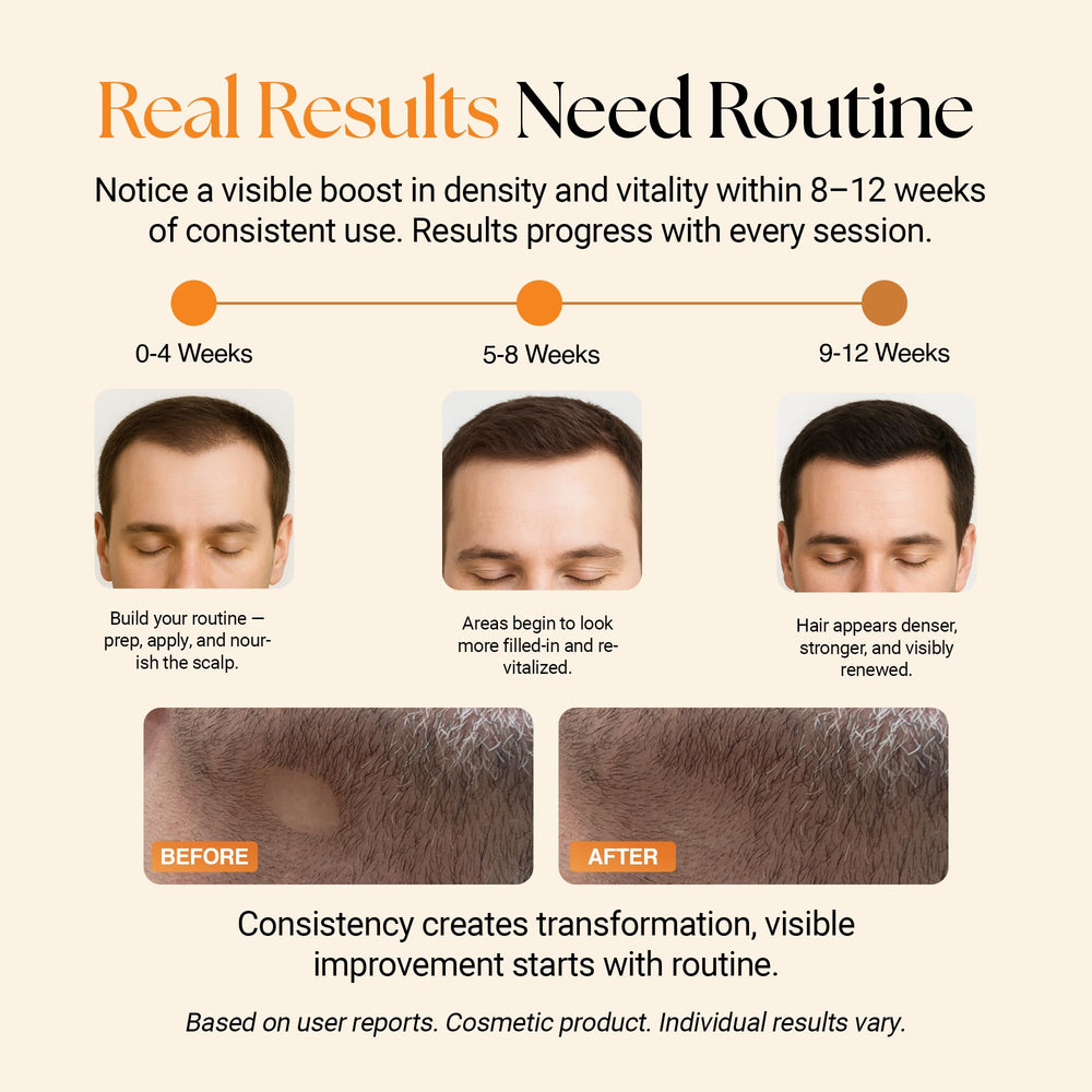 ReGlow plant exosome-like vesicles and botanicals for scalp vitality
