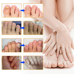 ReliCo patches moisturize and exfoliate the nail plate for smoother nails.