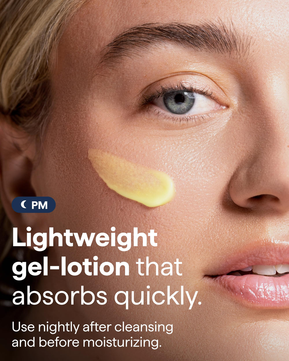 Remedy Science tranexamic acid illustration of discoloration reduction