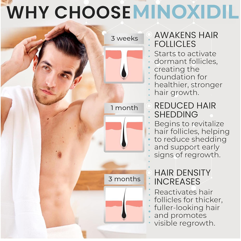 Remixidil foam applied on scalp during routine treatment.