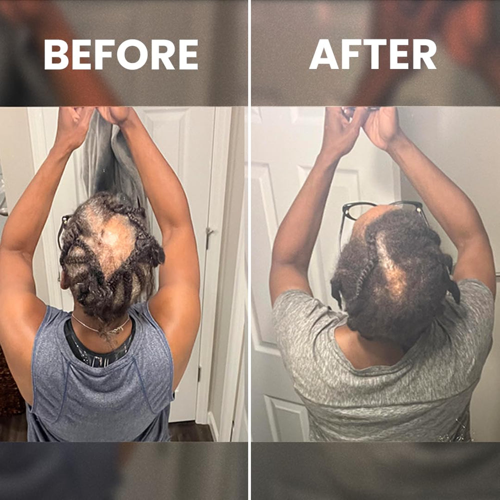 Rennora Hair Growth Serum massage motion demonstrates scalp treatment technique.