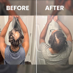 Rennora Hair Growth Serum massage motion demonstrates scalp treatment technique.