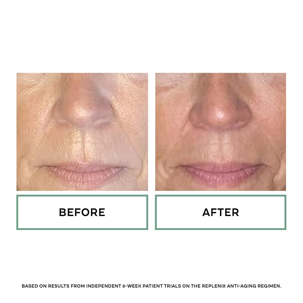 Replenix Antioxidant Hydrating Sunscreen closeup zinc-oxide particles indicate mineral protection