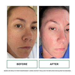 Replenix Glycolix Elite pad texture detail highlighting exfoliation