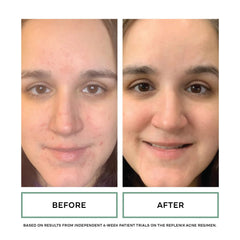 Green Tea Polyphenol Technology in Replenix Gentle Cleanser provides antioxidant support.