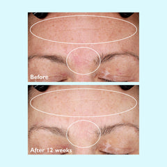 Restorsea Clinical-tested badge reinforces dermatologist-tested credibility.