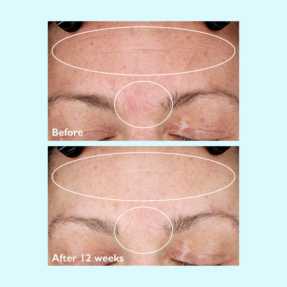 Restorsea Rejuvenating Day Cream dermatologist-tested label indicating hypoallergenic formula