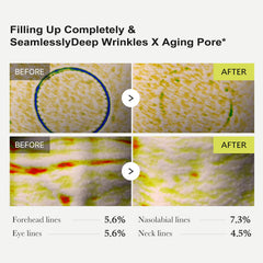 RETINAL SHOT wrinkles area appears smoother