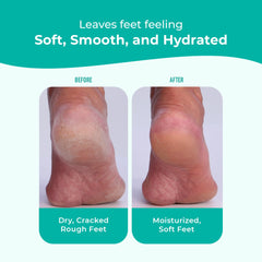 Richenna EZ Foot Cream supports dry foot care year-round.