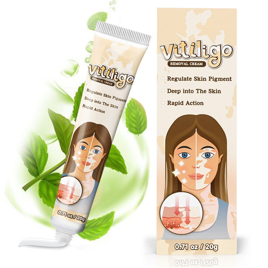 Richie House Vitiligo Cream bottle for easy nightly application