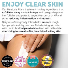 Rida Keratosis Pilaris Lotion provides deep moisture care.