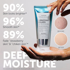 Rida Keratosis Pilaris Lotion pump enables easy daily application.