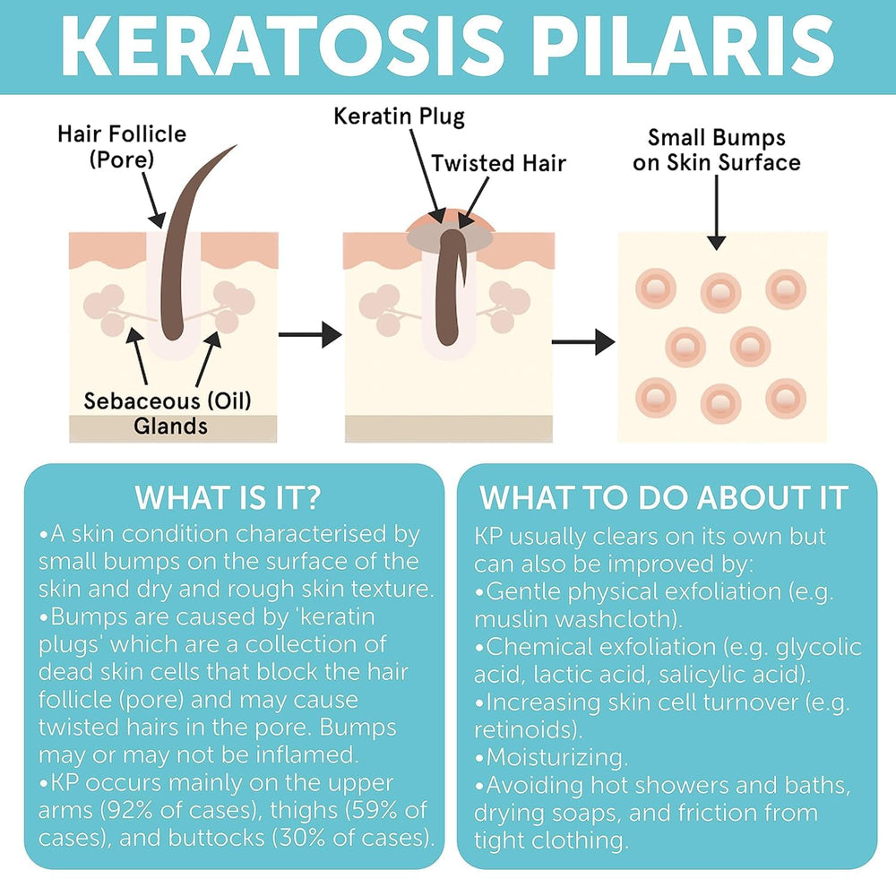 Rida Keratosis Pilaris Treatment bottle reminds daily sunscreen use.