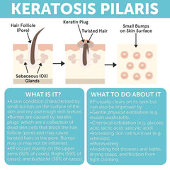 Rida Keratosis Pilaris Treatment bottle reminds daily sunscreen use.