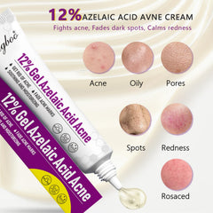 RIGBOO graphic highlights niacinamide and zinc PCA for oil control and barrier support.
