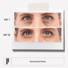 Close-up of Rodan + Fields Bright Eye Complex application showing smooth texture.