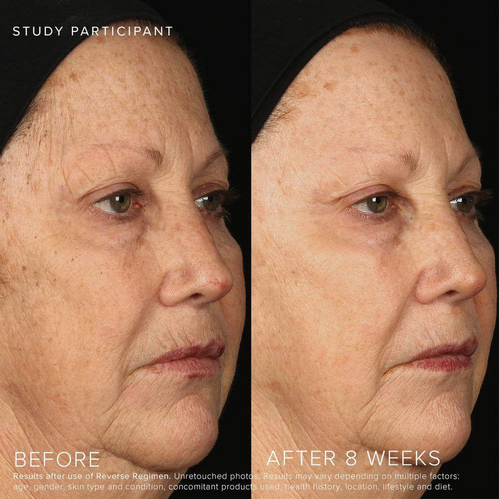 Rodan + Fields Reverse skincare kit packaging shown for a complete daily routine