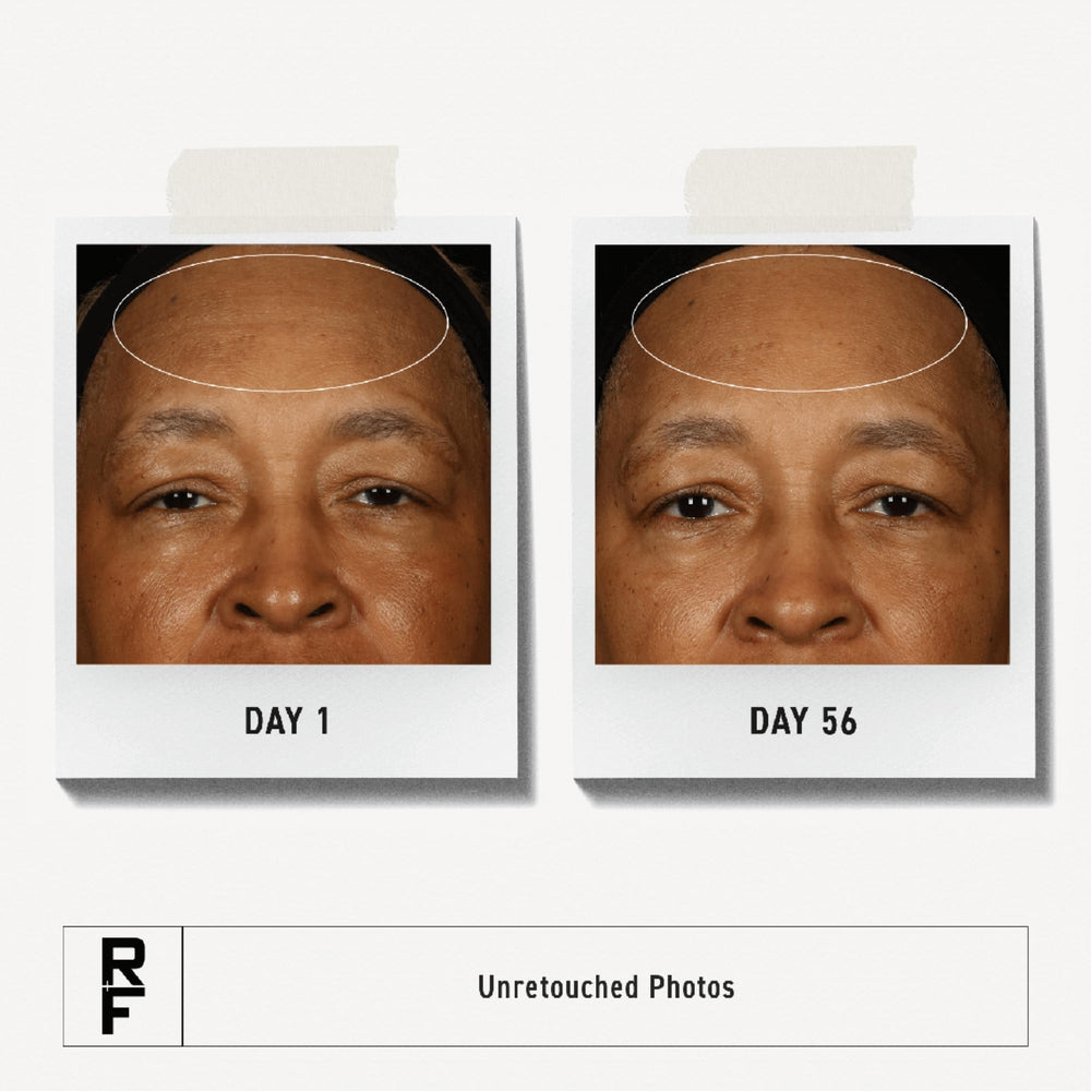 RODAN + FIELDS Step 3 PM bottle close-up highlighting premium packaging