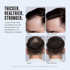 RootStim ingredient panel featuring Biotin, Rosemary, and caffeine icons.