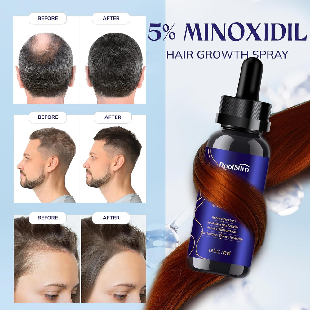 RootStim precision application kit demonstrates mess-free thinning area targeting.