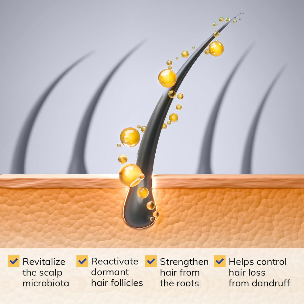 RootStim Seborrheic Dermatitis Shampoo with rosemary oil refreshes the scalp