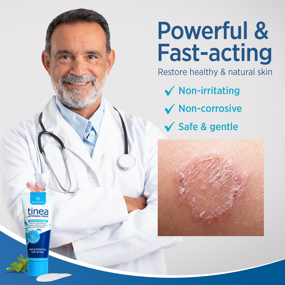 Roycederm ringworm treatment cream tube application demonstrates easy use.