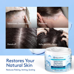 Roycederm Sebderm duo pack on display for complete scalp care routine