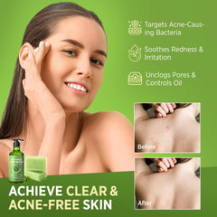 Roycederm Tea Tree Soap Bar closeup shows creamy lather and gentle cleansing.